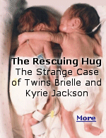 ''Let me just try putting Briele in with her sister, to see if it helps'', the nurse said to the alarmed parents. ''I don't know what else to do''.